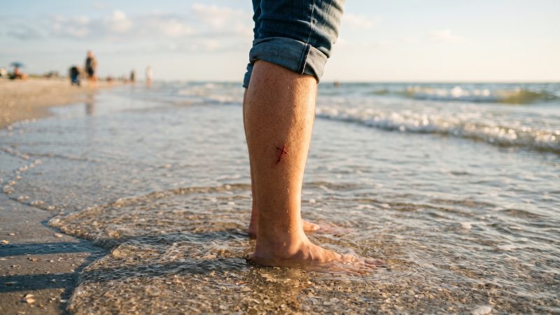 A shallow Gulf shoreline in warm afternoon light, with a healing cut visible on a wader's lower leg
